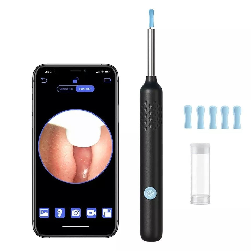 New LED Ear Wax Cleaner Ear Camera, Otoscope with Light- Cleaner ,Removal, Kit Set